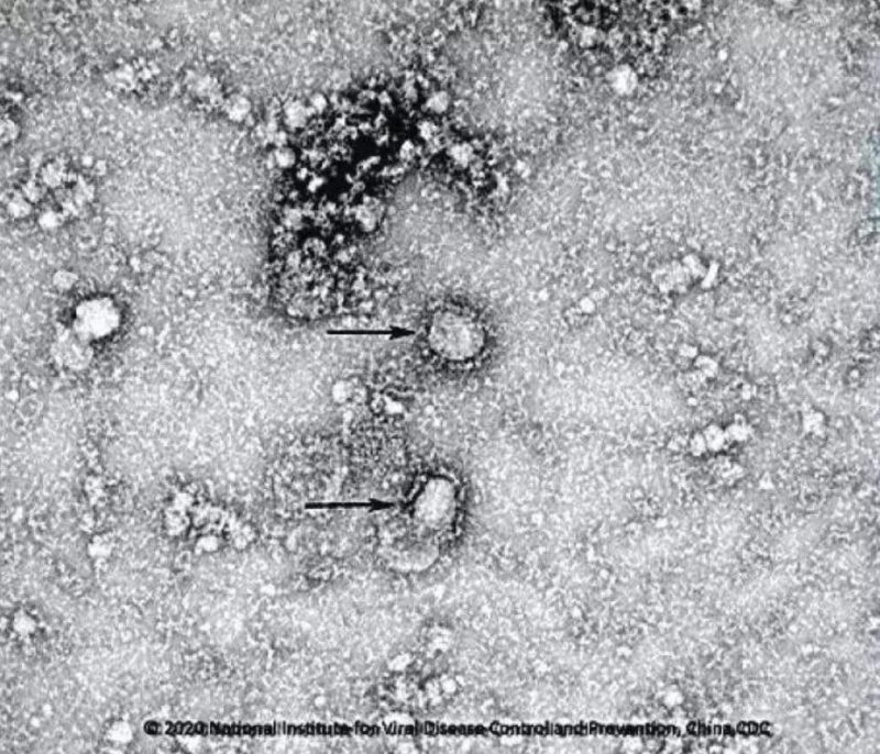 ▲新型冠狀病毒武漢株01。照片來(lái)源：國(guó)家病原微生物資源庫(kù)（中國(guó)疾病預(yù)防控制中心病毒病預(yù)防控制所）